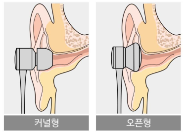 1427 ���� 3��° ����.png 372X270